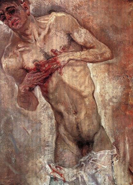 Oppenheimer, 1911, Bleeding